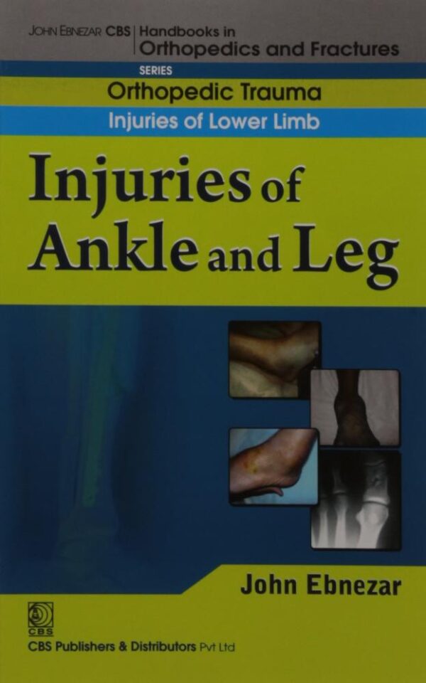 INJURIES OF ANKLE AND LEG (HANDBOOK OF ORTHOPEDICS AND FRATURES SERIES