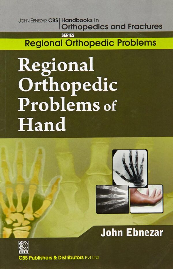 Regional Orthopedic Problems Of Hand (Handbooks In Orthopedics and Fractures Series