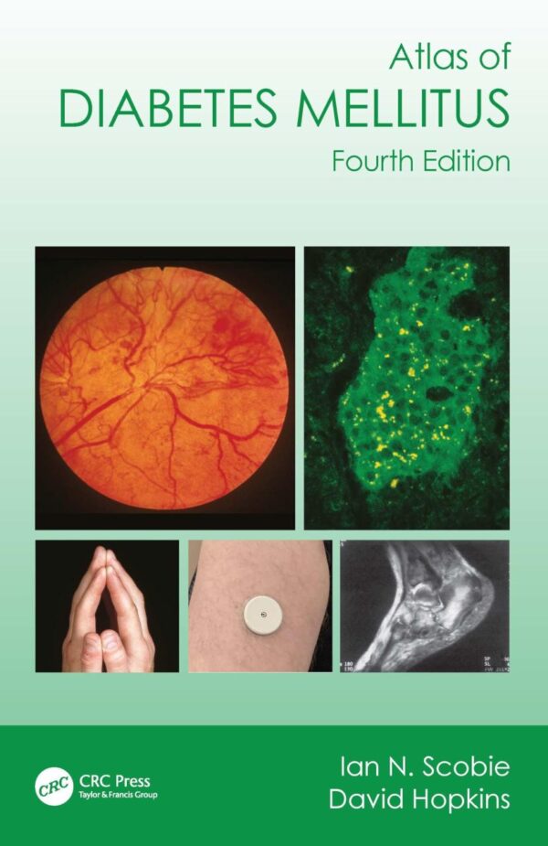 Atlas of Diabetes Mellitus