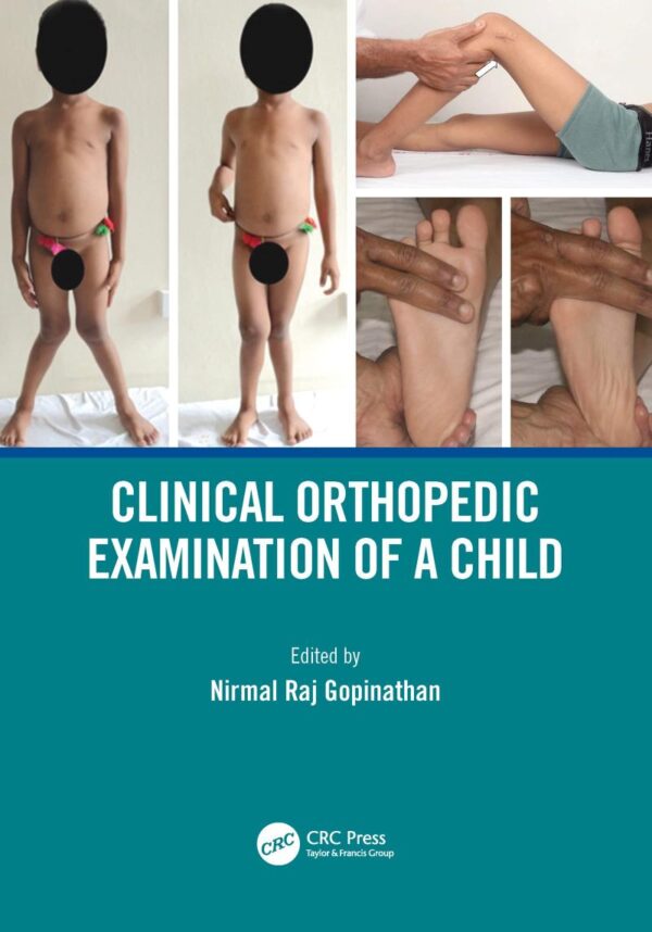 CLINICAL ORTHOPEDIC EXAMINATION OF A CHILD (PB 2021)