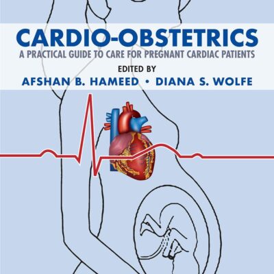 CARDIO OBSTETRICS A PRACTICAL GUIDE TO CARE FOR PREGNANT CARDIAC PATIENTS (PB 2020)