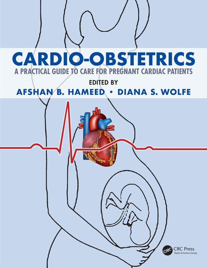 CARDIO OBSTETRICS A PRACTICAL GUIDE TO CARE FOR PREGNANT CARDIAC PATIENTS (PB 2020)