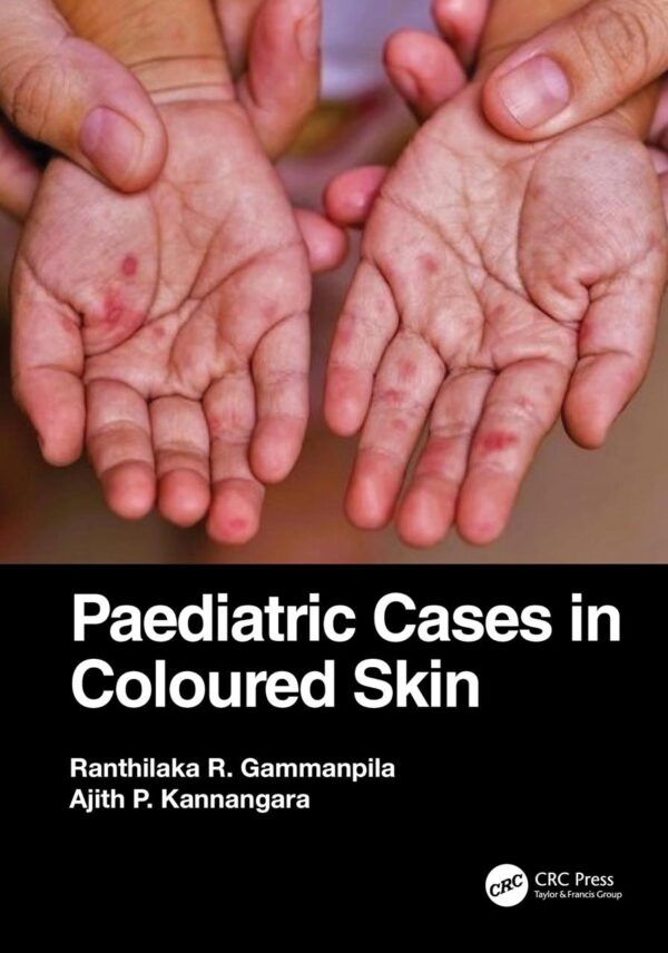 PAEDIATRIC CASES IN COLOURED SKIN (PB 2024)