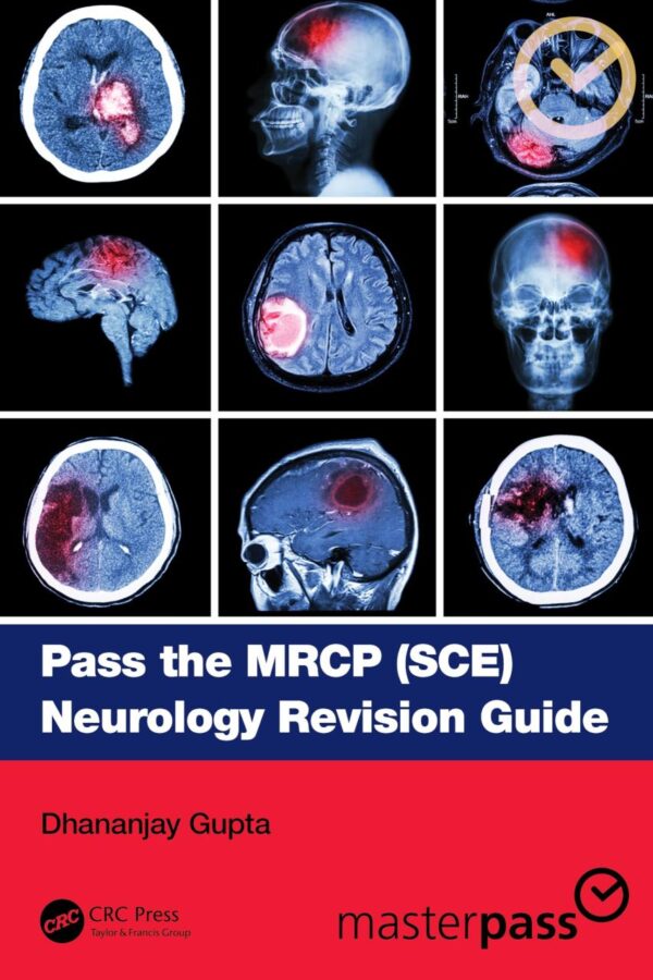 Pass The Mrcp Sce Neurology Revision Guide (Pb 2025)