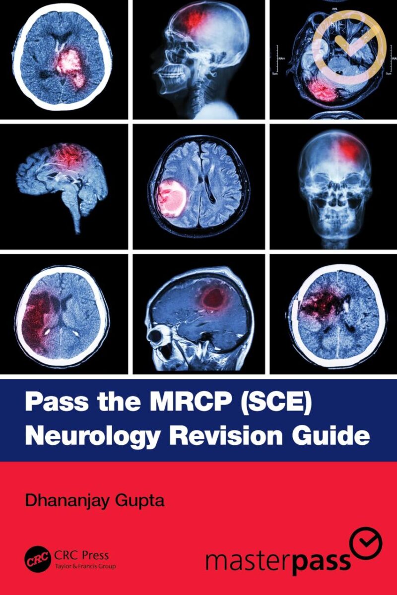 Pass The Mrcp Sce Neurology Revision Guide (Pb 2025)