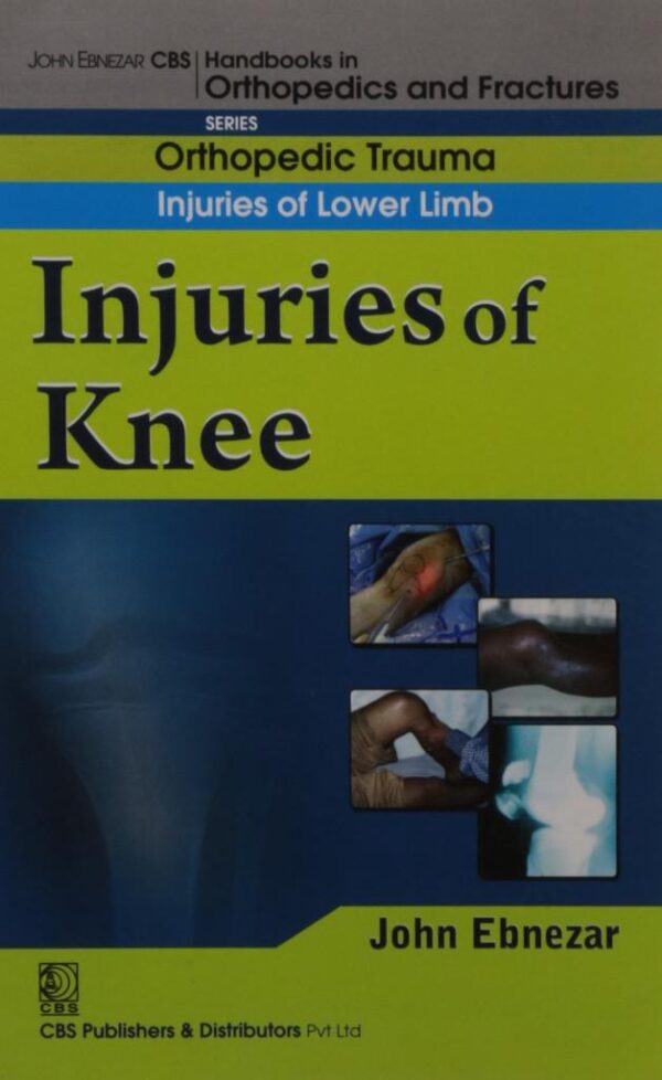 INJURIES OF KNEE (HANDBOOK OF ORTHOPEDICS AND FRACTURES SERIES