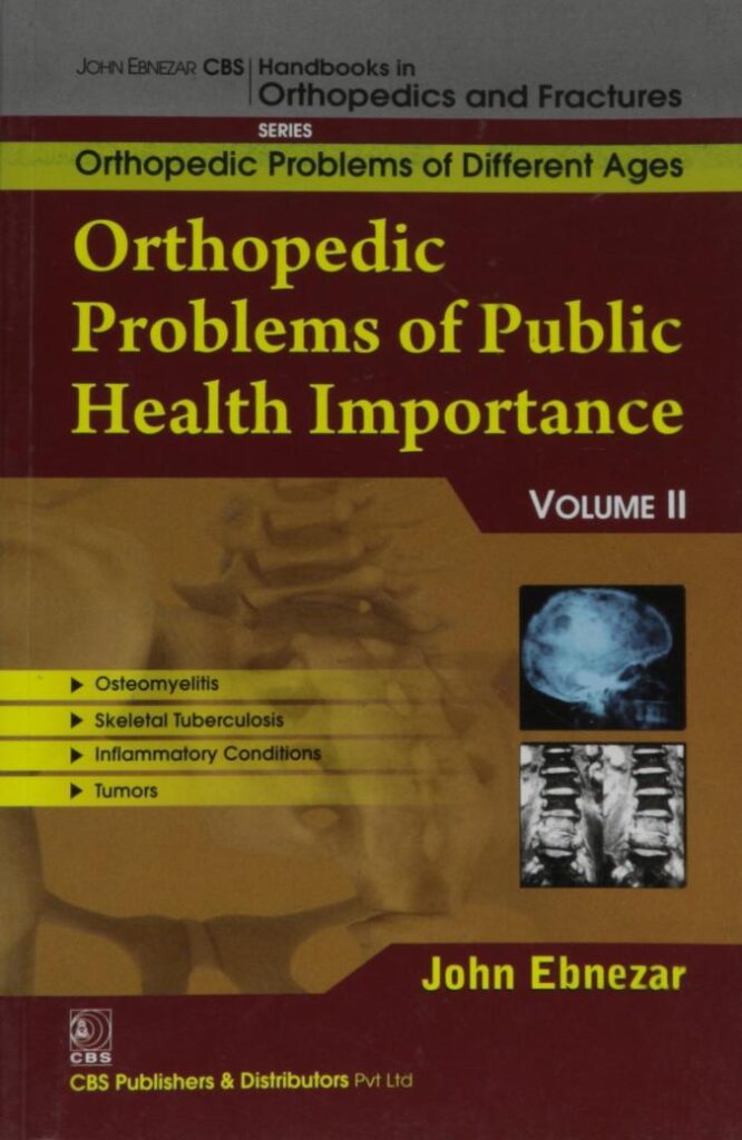 Orthopedic Problems Of Public Health Importance-11 (Handbooks In Orthopedics and Fractures Series
