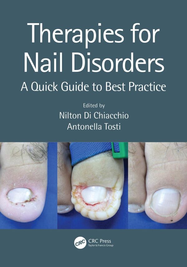 Therapies For Nail Disorders A Quick Guide To Best Practice (Pb 2020)