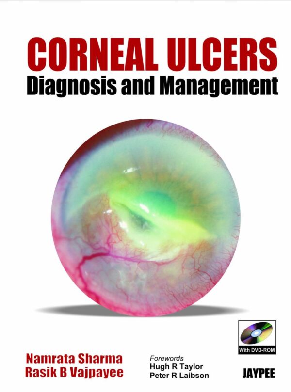 Corneal Ulcer Diagnosis and Management with DVD-ROM