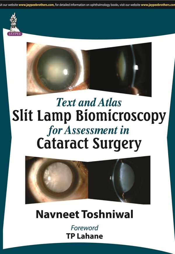 Text and Atlas Slit Lamp Biomicroscopy for Assessment in Cataract Surgery (POD)