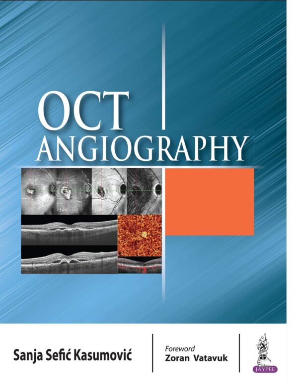 OCT Angiography