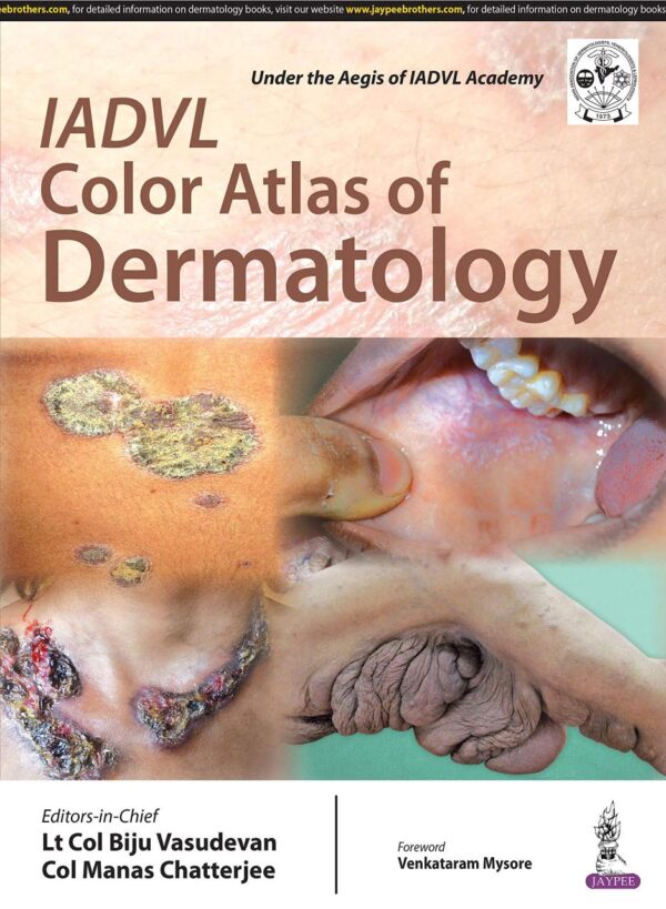 IADVL Color Atlas of Dermatology