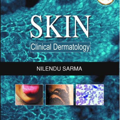 Skin: Clinical Dermatology