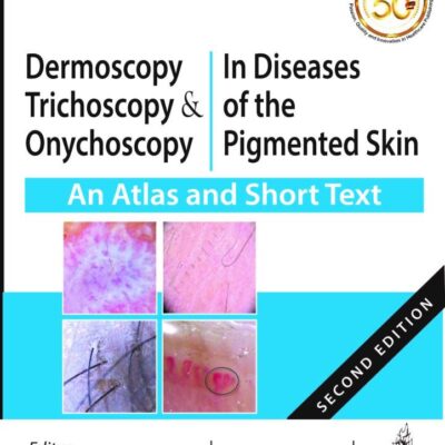 Dermoscopy