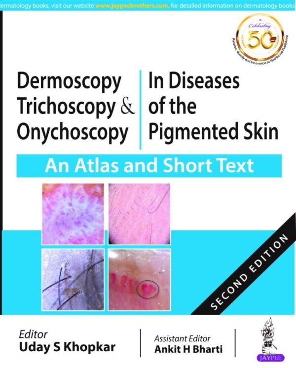 Dermoscopy