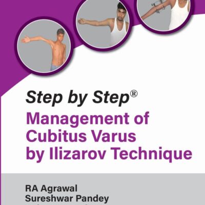Step by Step Management of Cubitus Varus by Ilizarov Technique
