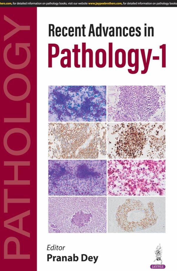 Recent Advances in Pathology-1