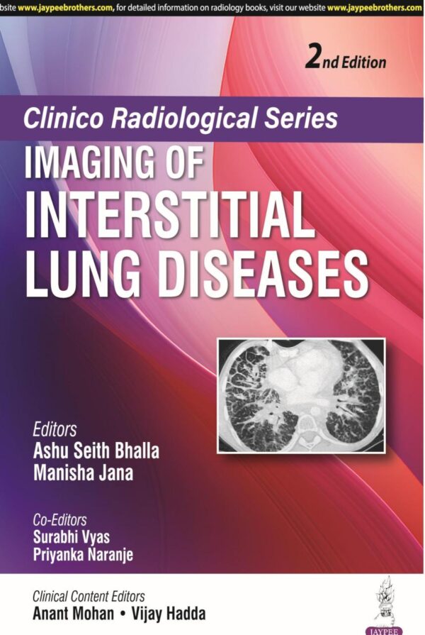 Clinico Radiological Series-Imaging of Interstitial Lung Diseases