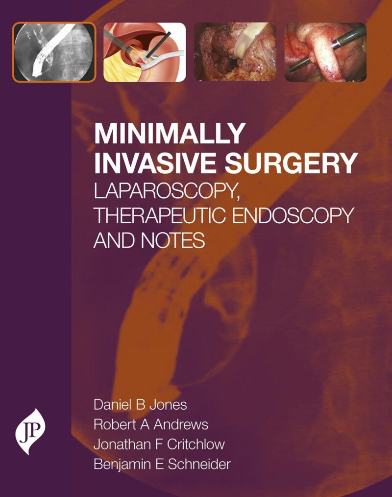 Minimally Invasive Surgery: Laparoscopy