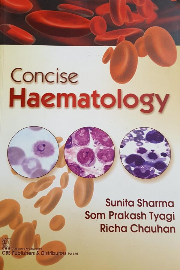 Concise Haematology (Pb 2018) [Paperback] SHARMA S