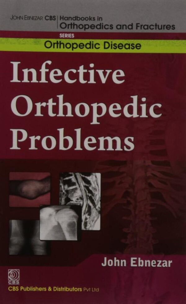 John Ebnezar CBS Handbooks in Orthopedics and Factures: Orthopedic Disease: Infective Orthopedic Problems [Paperback] Ebnezar