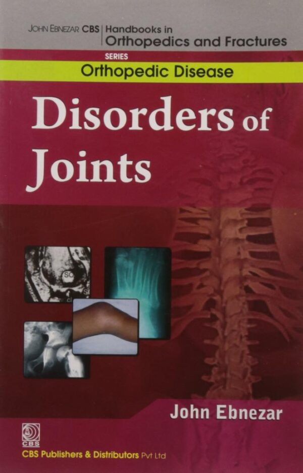 John Ebnezar CBS Handbooks in Orthopedics and Factures: Orthopedic Disease: Disorders of the Joints [Hardcover] Bhattacharya