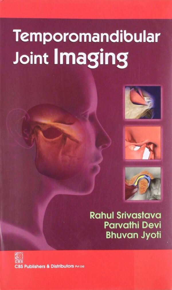 TEMPOROMANDIBULAR JOINT IMAGING (PB-2014) [Paperback] SRIVASTAVA R.