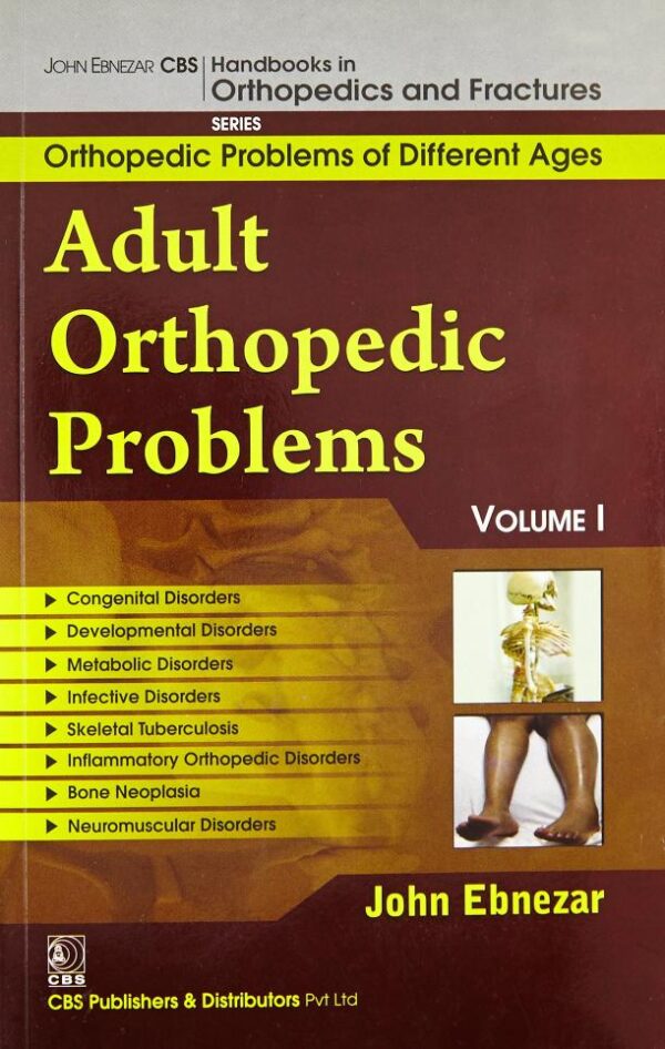Adult Orthopedic Problems