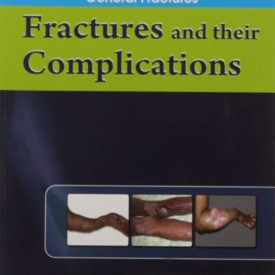 FRACTURES AND THEIR COMPLICATIONS (HANDBOOK IN ORTHOPEDICS AND FRACTURES VOL.3 - ORTHOPEDIC TRAUMA GENERAL FRACTURES): Orthopedic Trauma General Fractures: Fractures and their Complications [Paperback] EBNEZAR J.