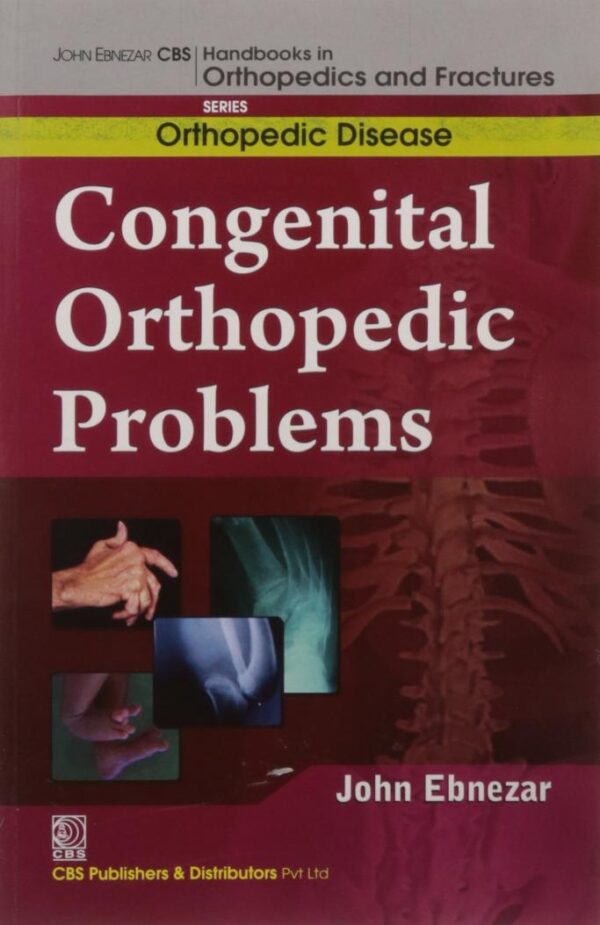 CONGENITAL ORTHOPEDIC PROBLEMS (HANDBOOKS IN ORTHOPEDICS AND FRACTURES SERIES