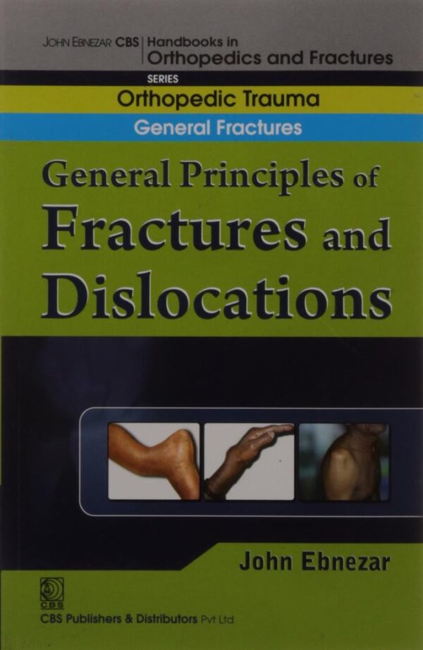 GENERAL PRINCIPLES OF FRACTURES AND DISLOCATIONS (HANDBOOK OF ORTHOPEDICS AND FRACTURES SERIES