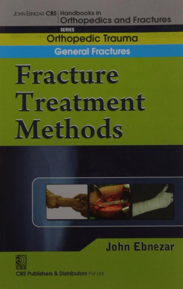 FRACTURE TREATMENT METHODS (HANDBOOK IN ORTHOPEDICS AND FRACTURES VOL.02 - ORTHOPEDIC TRAUMA GENERAL FRACTURES): Orthopedic Trauma General Fractures: Fracture Treatment Methods [Paperback] EBNEZAR J.