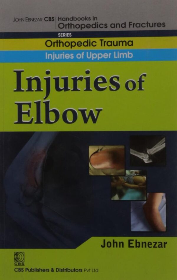 INJURIES OF ELBOW (HANDBOOK IN ORTHOPEDICS AND FRACTURES VOL.7 - ORTHOPEDIC TRAUMA INJURIES OF UPPER LIMB): Orthopedic Trauma Injuries of Upper Limb: Injuries of Elbow [Paperback] EBNEZAR J.