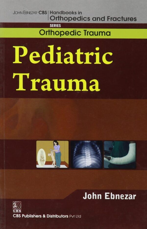 John Ebnezar CBS Handbooks in Orthopedics and Factures: Orthopedic Trauma: Pediatric Trauma [Hardcover] Ebnezar