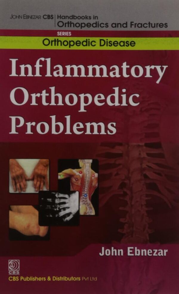 Inflammatory Orthopedic Problems (Handbooks In Orthopedics and Fractures Series