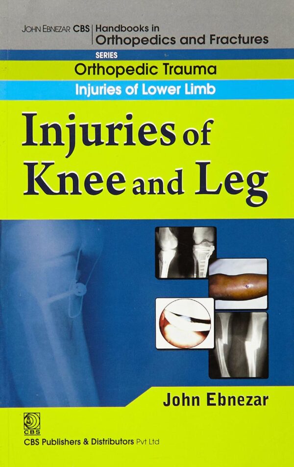 INJURIES OF KNEE AND LEG ( HANDBOOK IN ORTHOPEDICS AND FRACTURES SERIES VOL.16- ORTHOPEDIC TRAUMA INJURIES OF LOWER LIMB): Orthopedic Trauma Injuries of Lower Limb: Injuries of Knee and Leg [Paperback] EBNEZAR J.