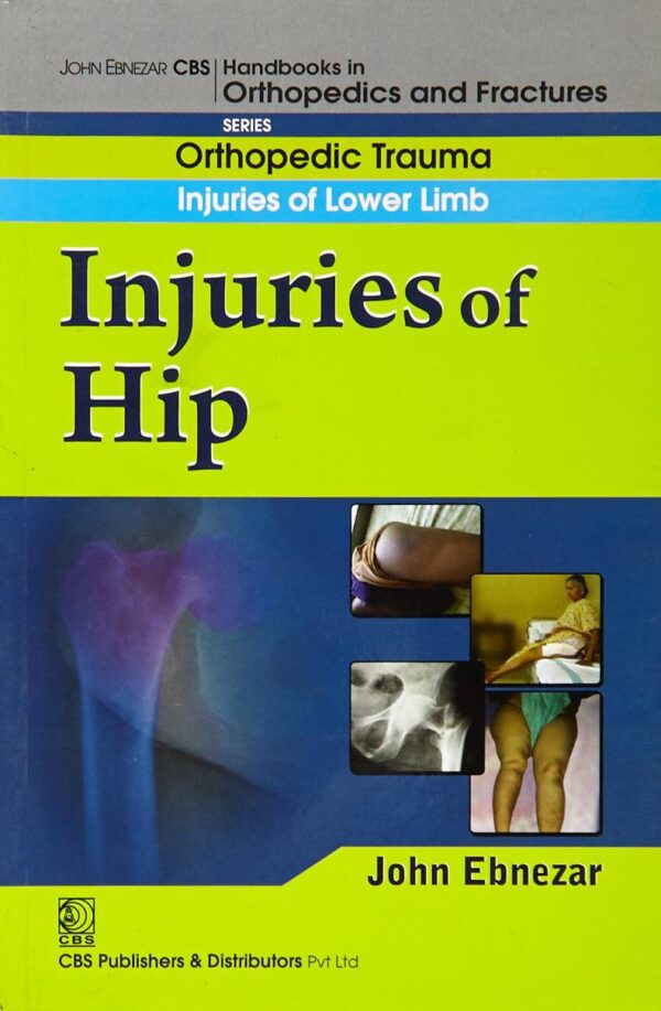 INJURIES OF HIP (HANDBOOK OF ORTHOPEDICS AND FRATURES SERIES