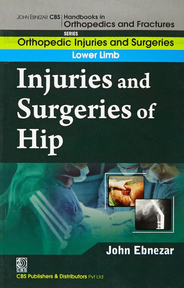 INJURIES AND SURGERIES OF HIP (HANDBOOKS IN ORTHOPEDICS AND FRACTURES SERIES