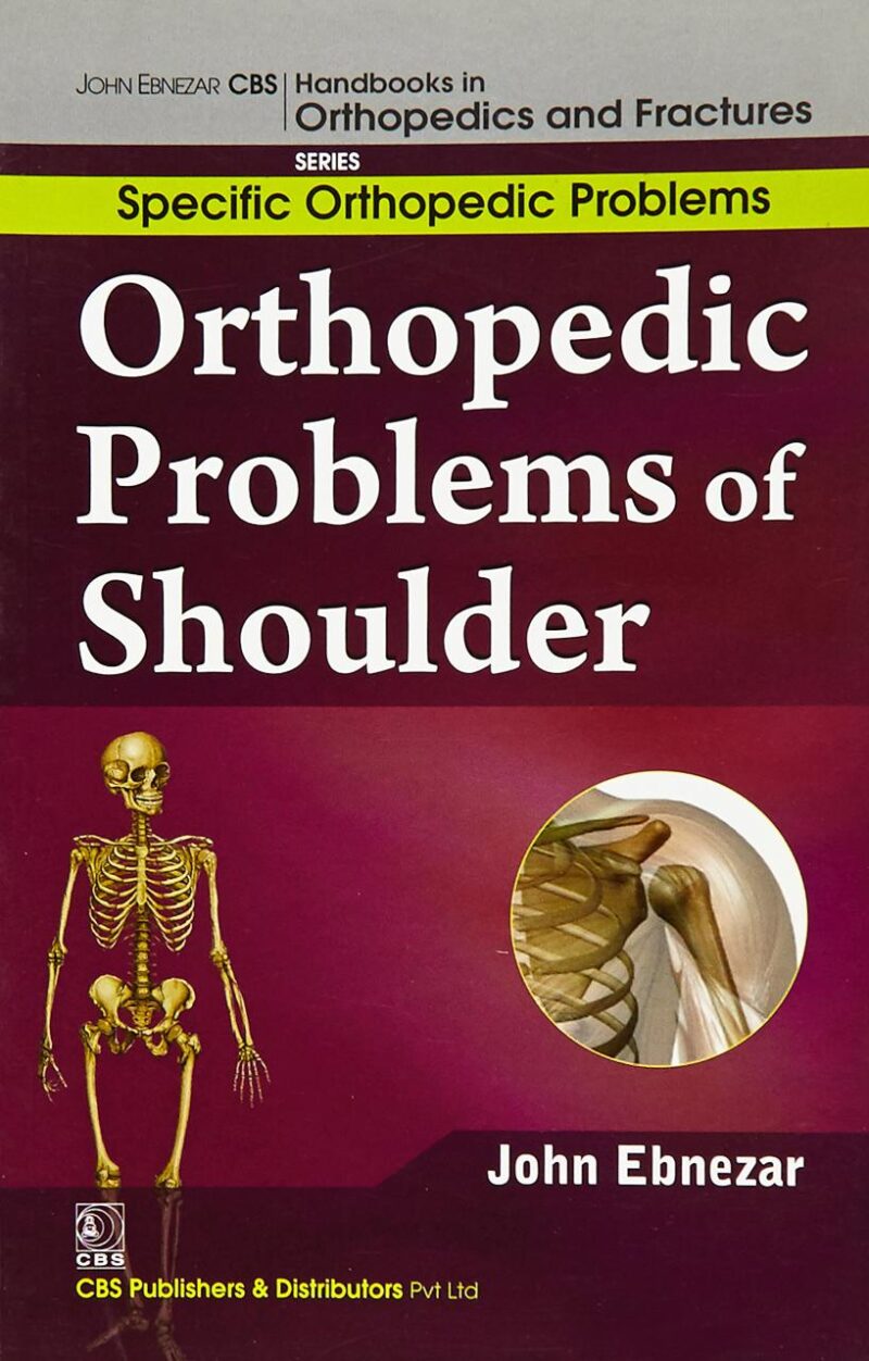 Orthopedic Problems Of Shoulder (Handbooks In Orthopedics and Fractures Series