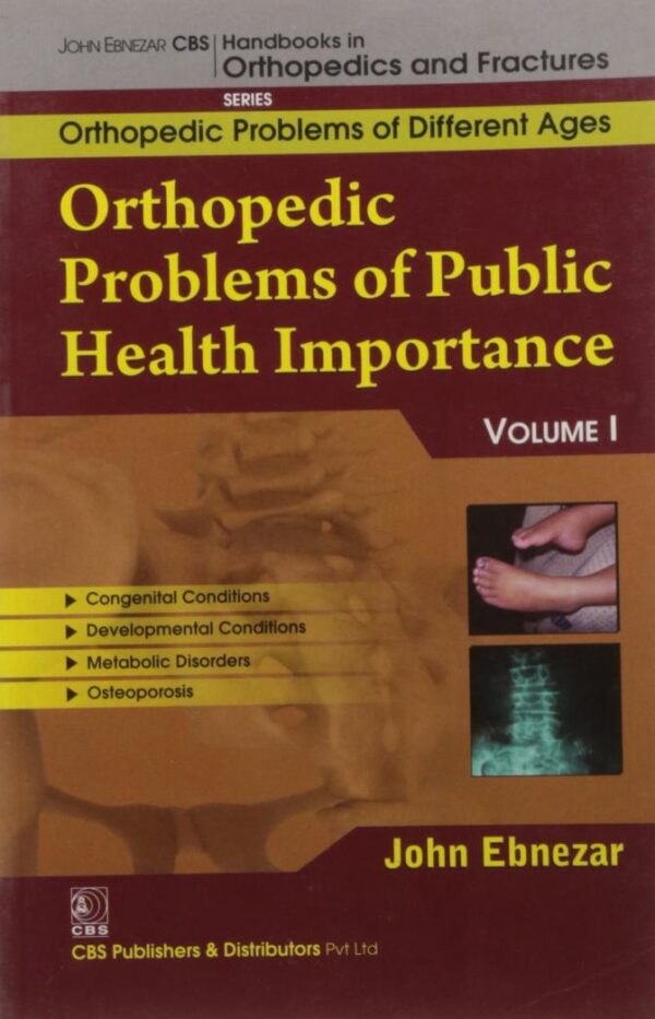ORTHOPEDIC PROBLEMS OF PUBLIC HEALTH IMPORTANCE (HANDBOOKS OF ORTHOPEDICS AND FRACTURES SERIES