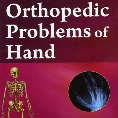 Orthopedic Problems Of Hand (Handbooks In Orthopedics and Fractures Series