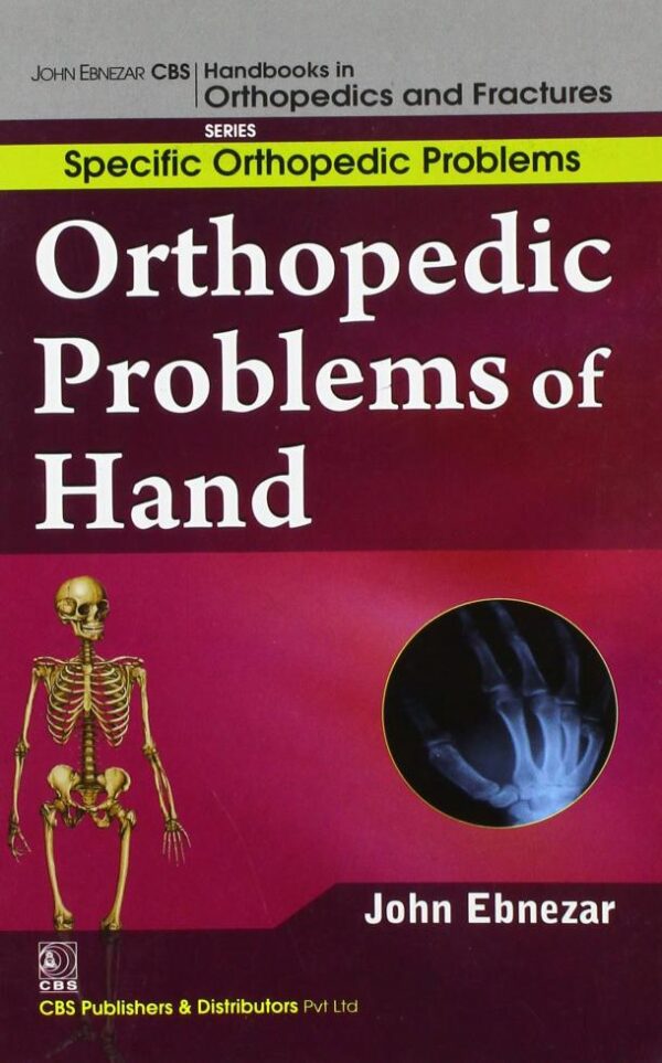 Orthopedic Problems Of Hand (Handbooks In Orthopedics and Fractures Series