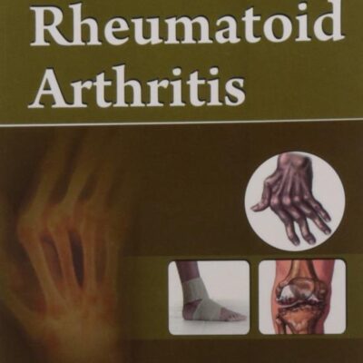 RHEUMATOID ARTHRITIS (HANDBOOKS IN ORTHOPEDICS AND FRACTURES SERIES