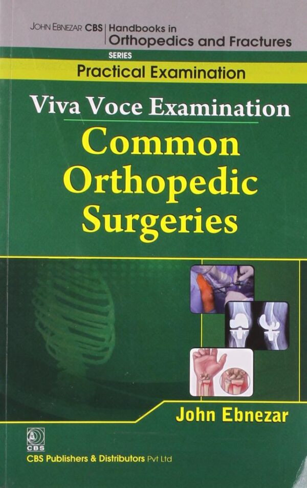 VIVA VOCE EXAMINATION COMMON ORTHOPEDIC SURGERIES (HANDBOOKS IN ORTHOPEDICS AND FRACTURES SERIES