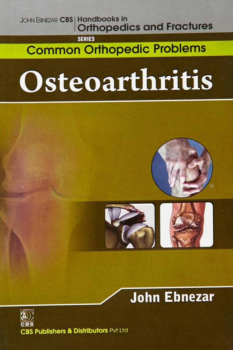 Osteoarthritis (Handbooks In Orthopedics and Fractures Series