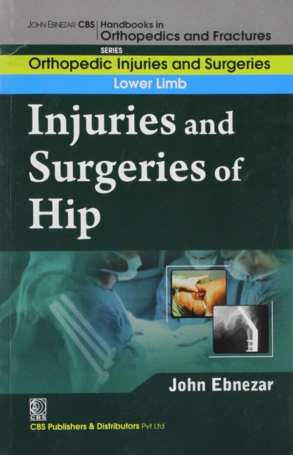 Injuries And Surgeries Of Forearm (Handbooks In Orthopedics And Fractures Series