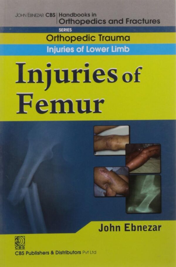 IN JURIES OF FEMUR (HANDBOOK IN ORTHOPEDICS AND FRACTURES VOL.14 - ORTHOPEDIC TRAUMA INJURIES OF LOWER LIMB): Orthopedic Trauma Injuries of Lower Limb: Injuries of Femur [Paperback] EBNEZAR J.