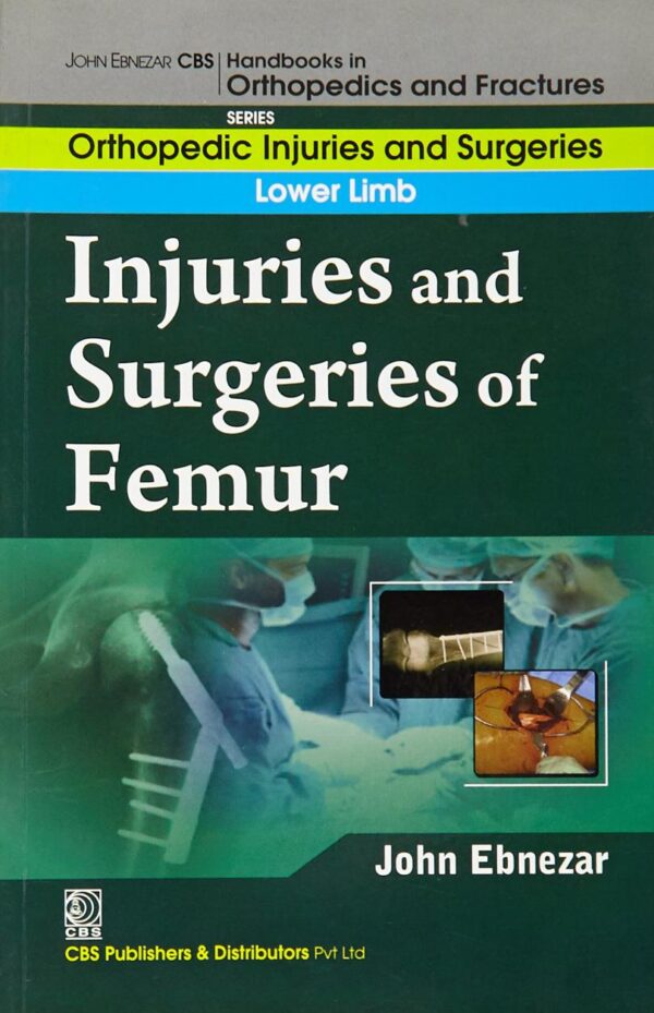 Injuries and Surgeries Of Femur (Handbooks In Orthopedics and Fractures Series