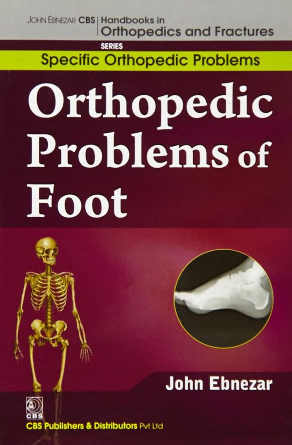 ORTHOPEDIC PROBLEMS OF FOOT (HANDBOOKS IN ORTHOPEDICS AND FRACTURES SERIES