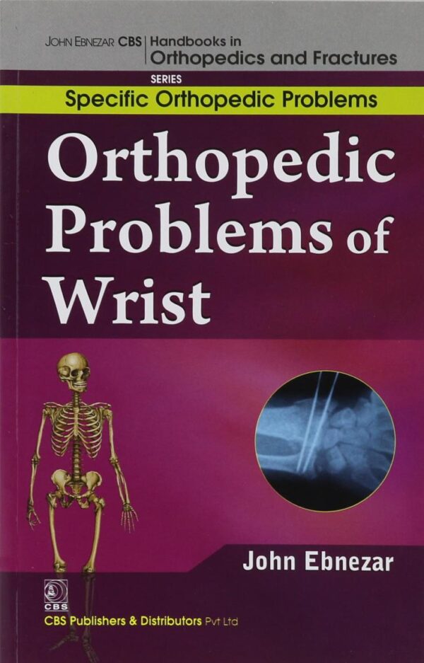 ORTHOPEDIC PROBLEMS OF WRIST (HANDBOOKS IN ORTHOPEDICS AND FRACTURES SERIES